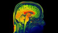 UNM researchers taking hard look at concussions in student athletes