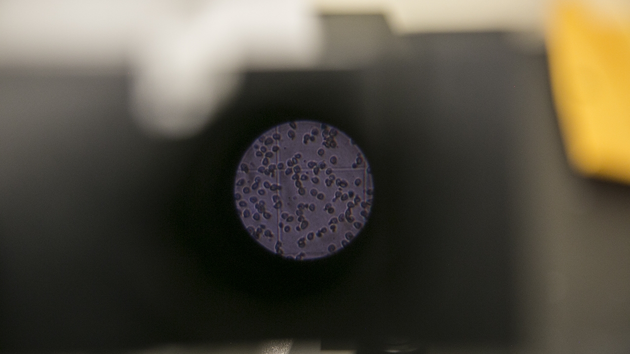 Cancer Cells in Microscope