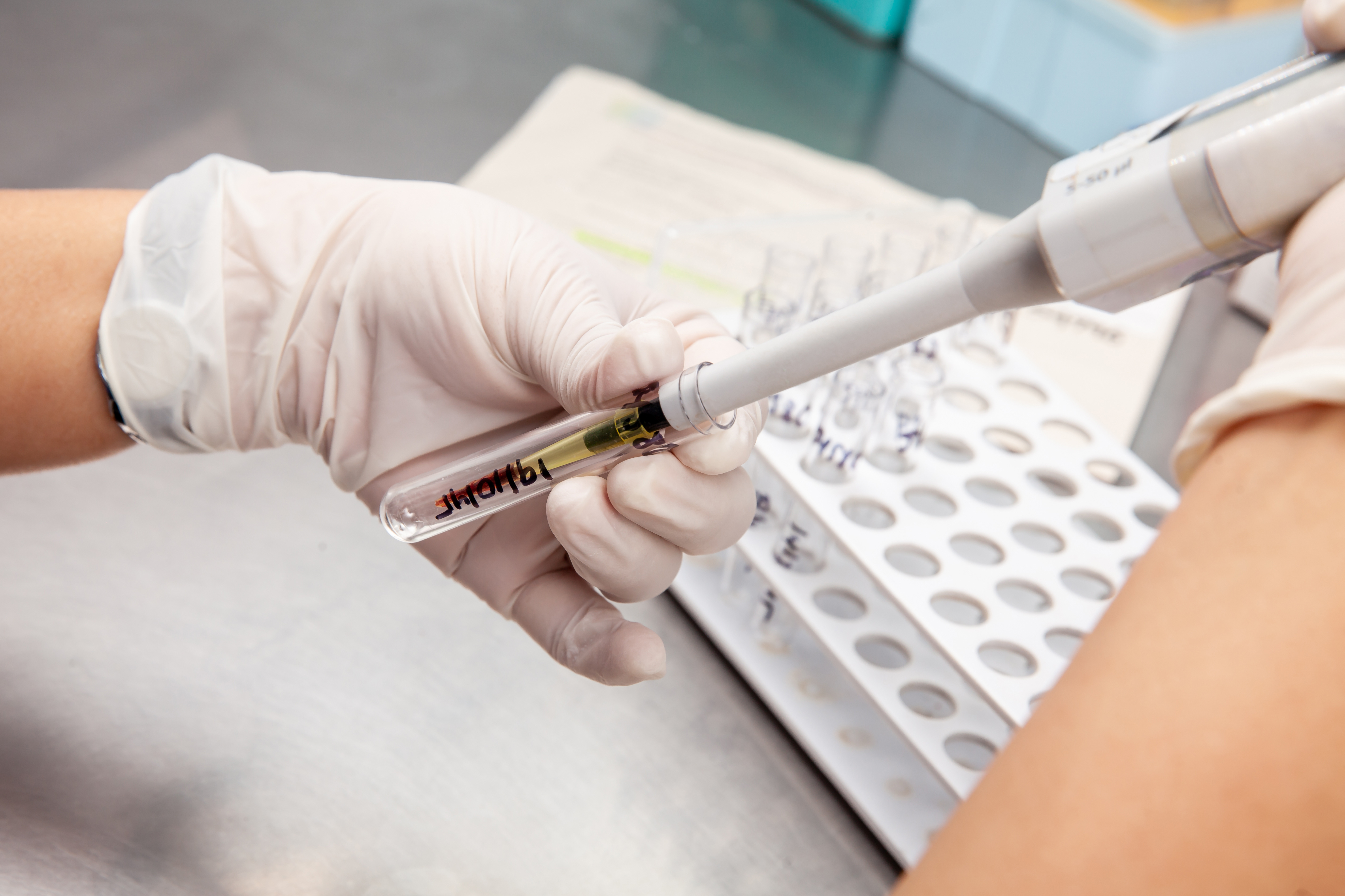 Flow cytometry