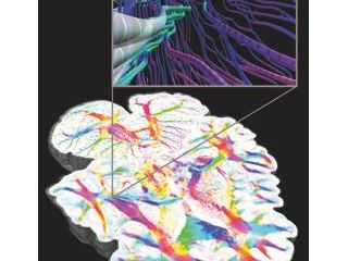 Brain Research Image