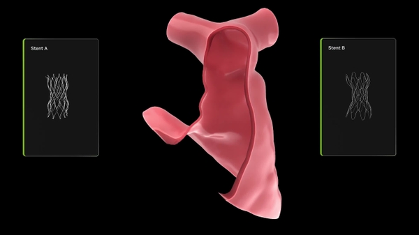 Heart of the Matter: How a Major Children’s Hospital Uses Open Source NVIDIA AI for Cardiac Care