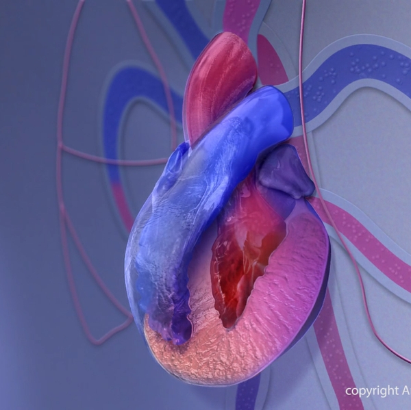 Cardiomyopathy+illustration