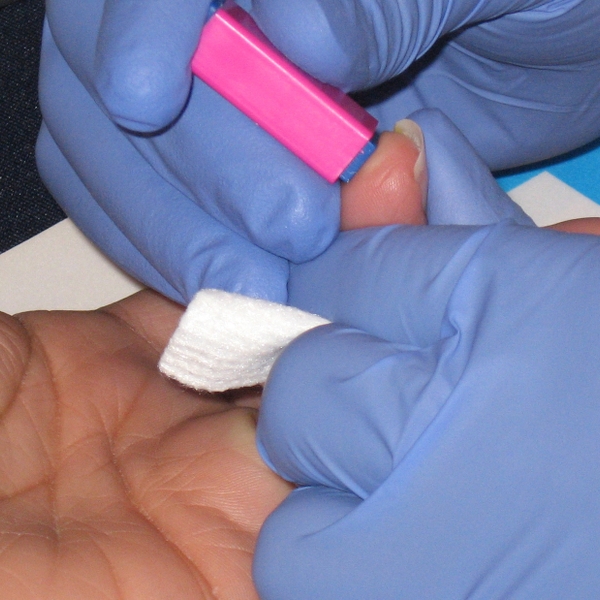 PIC-Needle_Prick_on_Finger