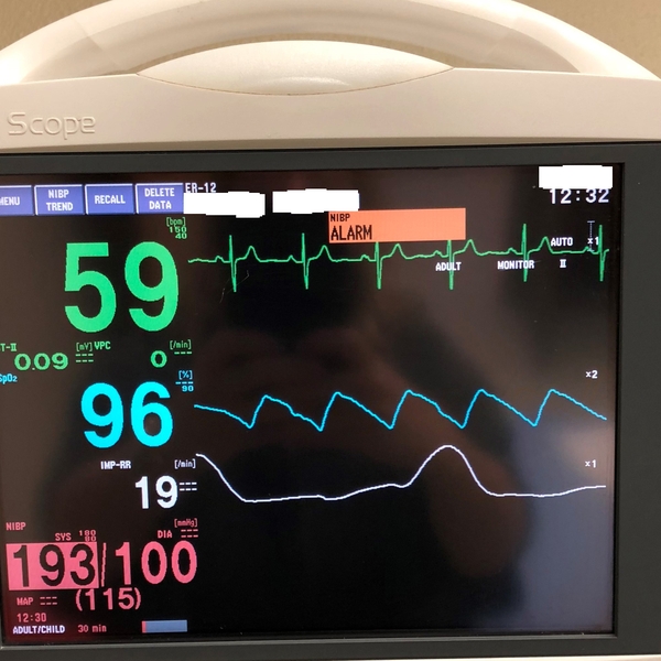 Heart+Monitor+close+up