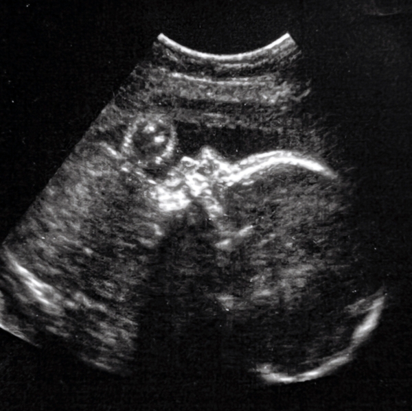 Healthy+baby+in+utero