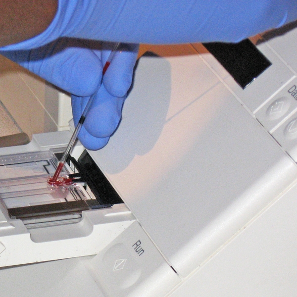 PIC-Cholesterol_test_1