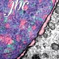 Paper of the Month: The Structure of Lombricine Kinase