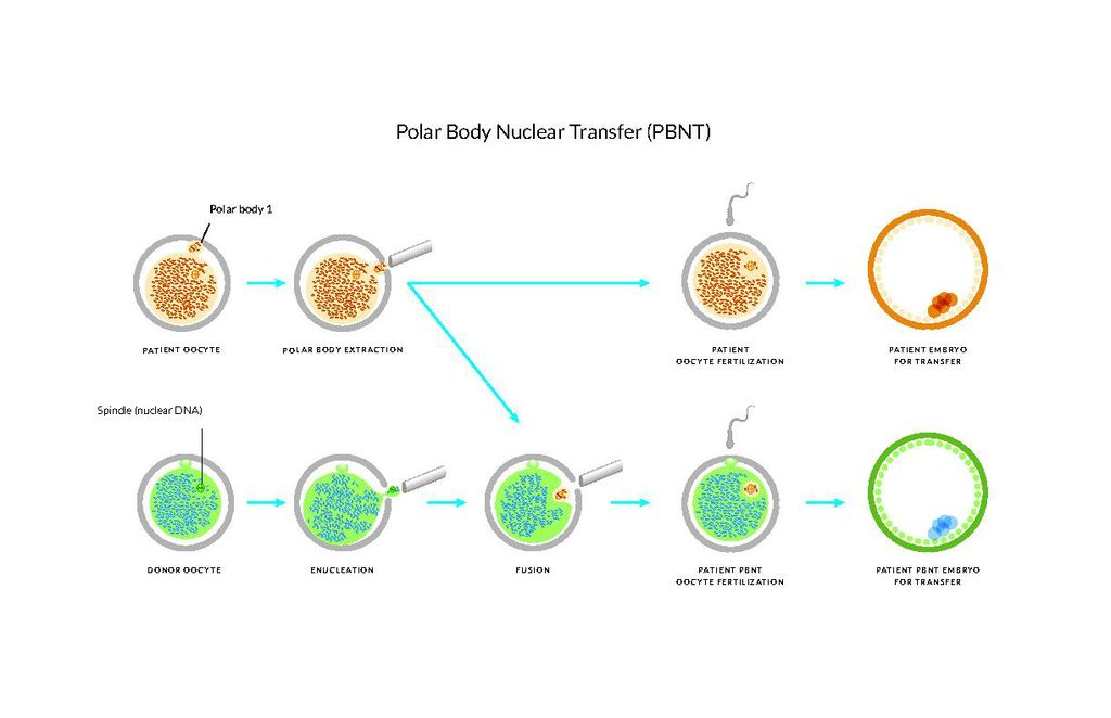 Polar Body Graphic