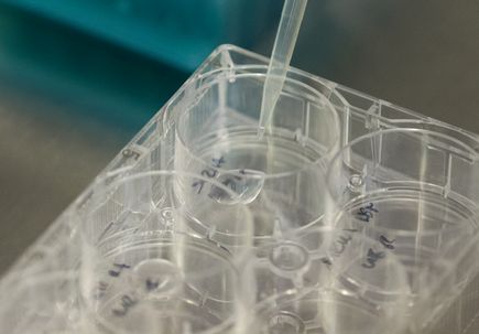 Promising microRNA study