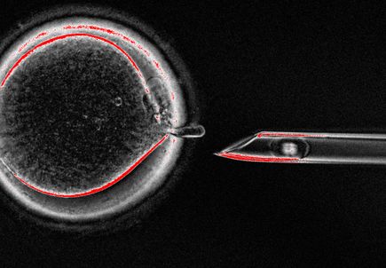 Mitalipov: Mitochondrial replacement therapy (2016)