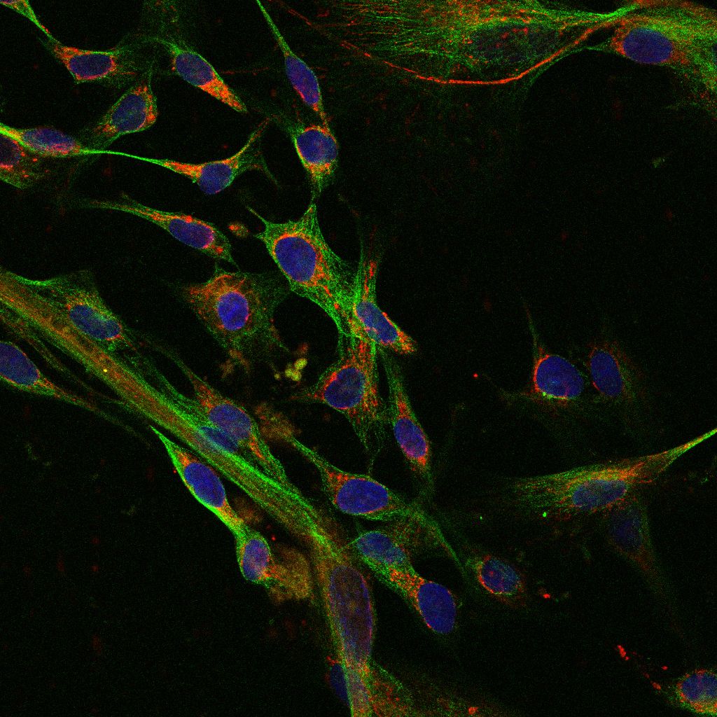 Mitochondria