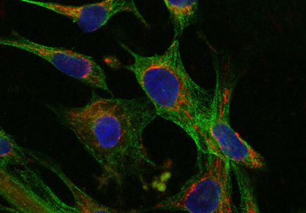 Mitochondria