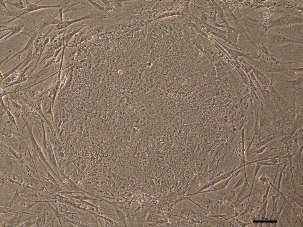 Mutant-iPSCs