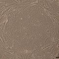 Mutant-iPSCs