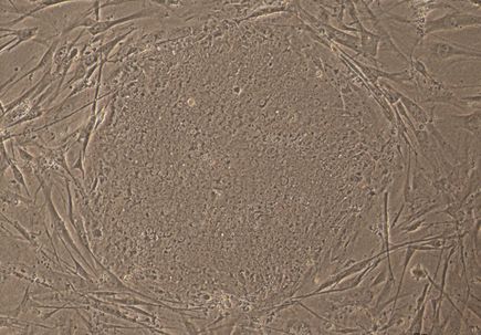 Mutant-iPSCs