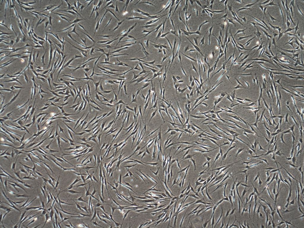 Gene therapy