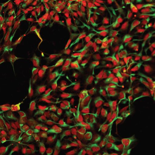 Gene therapy