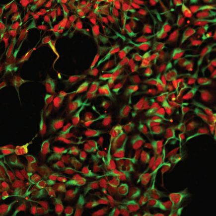 Gene therapy