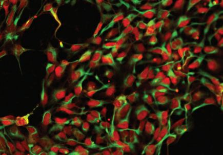 Gene therapy