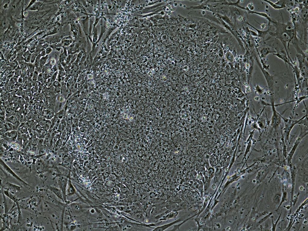 Gene therapy