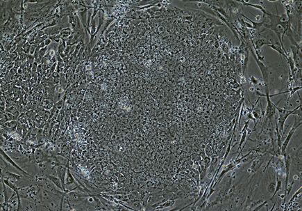Gene therapy