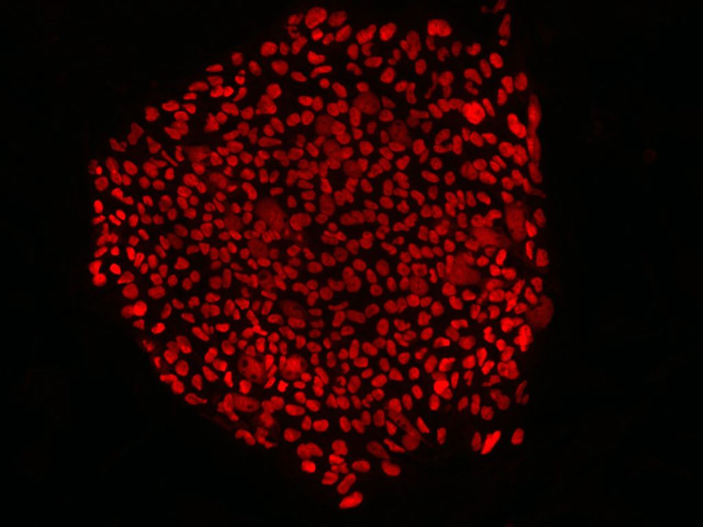 Gene therapy