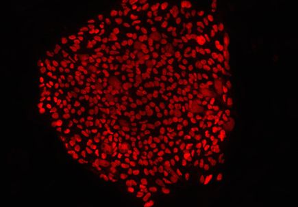 Mitalipov: Creating embryonic stem cells to replace diseased mitochondrial DNA (2015)