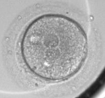 Zygote 1-cell stage