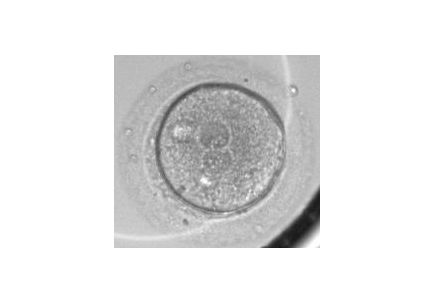 Zygote 1-cell stage