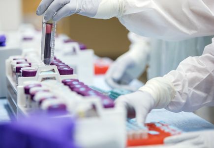 HIV vaccine