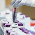 May 16: OHSU scientist to discuss TB, HIV vaccine research, clinical trials