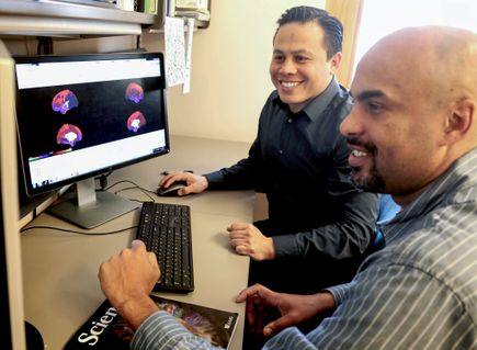 Brain connectivity