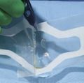 Halo graft