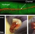 New research on root canal treatment
