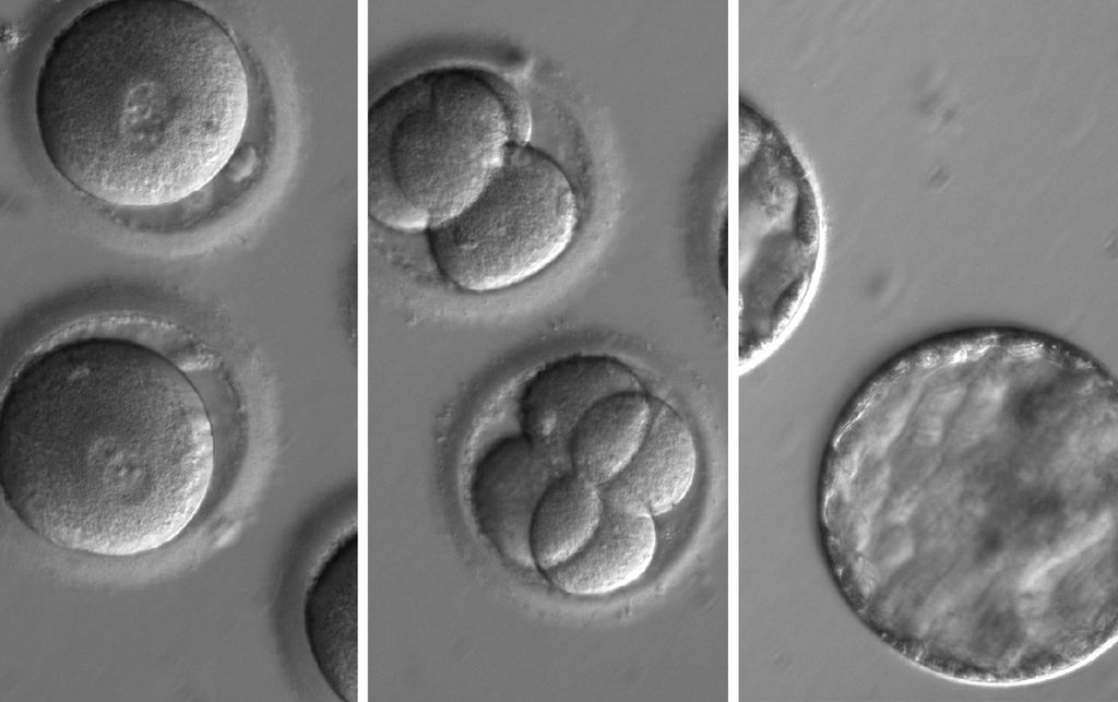 Germline editing