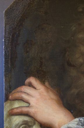 Revel: Before treatment detail