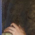 Revel: Before treatment detail