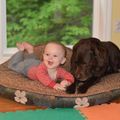 Hydrocephalus: Baby Jake