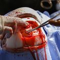 Brain surgery simulator