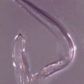 Thelazia gulosa - cattle eyeworm
