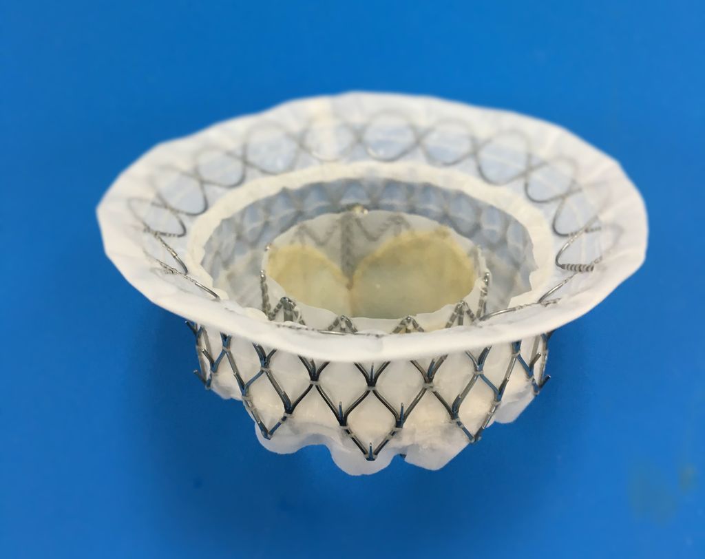 Medtronic’s IntrepidTM Transcatheter Mitral Valve Replacement