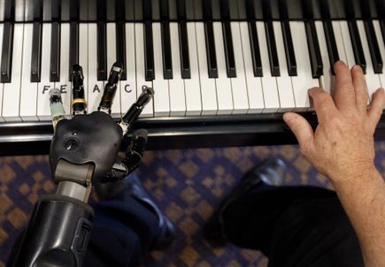 Thought-controlled bionic arm