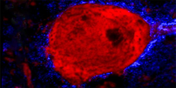 microscope image depicting a red brain cell surrounded by a blue molecular net