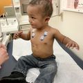Pediatric congenital heart defect