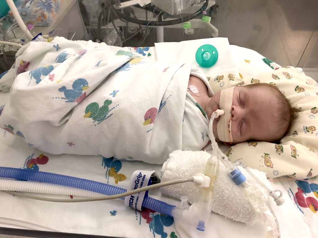 Swaddled infant, in hospital crib, with tubes in his nose