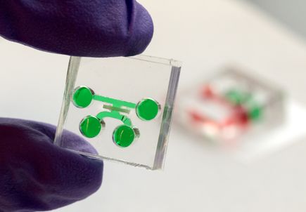 Tooth-on-a-chip