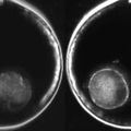 VIDEO DOWNLOAD: Excluded cellular fragments left and blastomeres right