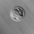 Rhesus embryo cellular fragmentation