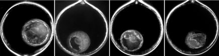 Rhesus excluded blastomeres first 3 and fragments last