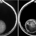 Rhesus excluded blastomeres first 3 and fragments last